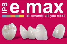 Răng sứ E.max Răng sứ E.max